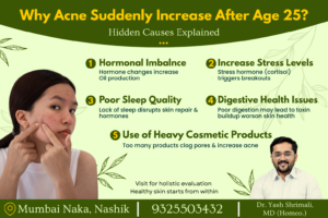 Infographic explaining why acne suddenly increases after age 25 including hormonal imbalance, poor sleep quality, digestive health issues, stress, and heavy cosmetic products.